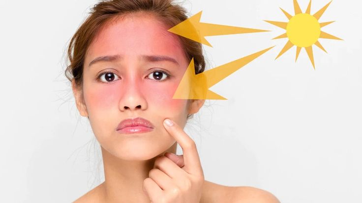 how to remove tan from skin naturally illustrated by woman with sunburned face and sun rays pointing to tanned cheeks