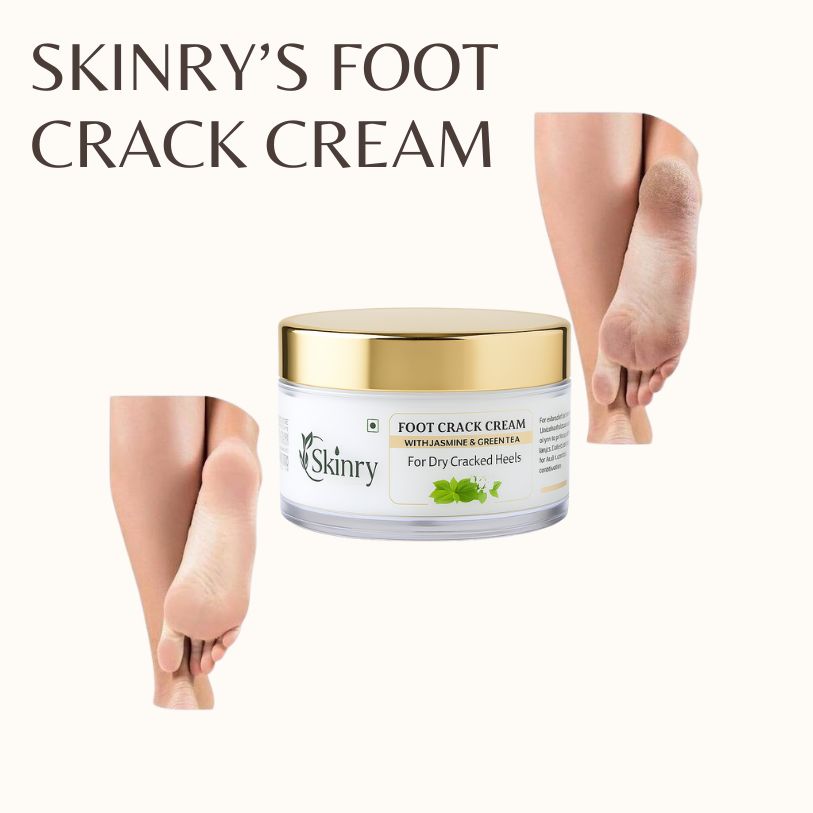 Skinry foot crack cream jar with gold lid and cracked heels before and after images best cream for cracked feet