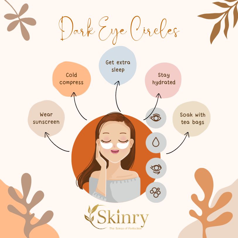 Skinry Store infographic showing woman with under eye patches and tips for dark circles highlighting best eye gel for puffiness