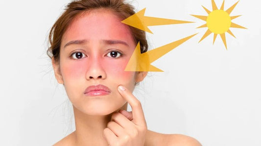 how to remove tan from skin naturally illustrated by woman with sunburned face and sun rays pointing to tanned cheeks