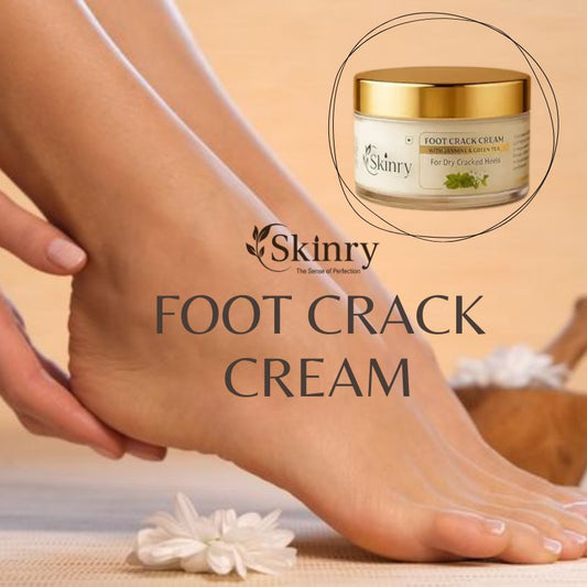 My Store foot crack cream jar beside smooth bare heels demonstrating moisturizing balm best cream for cracked feet